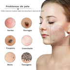Caneta Plasma Elétrica 19 Níveis