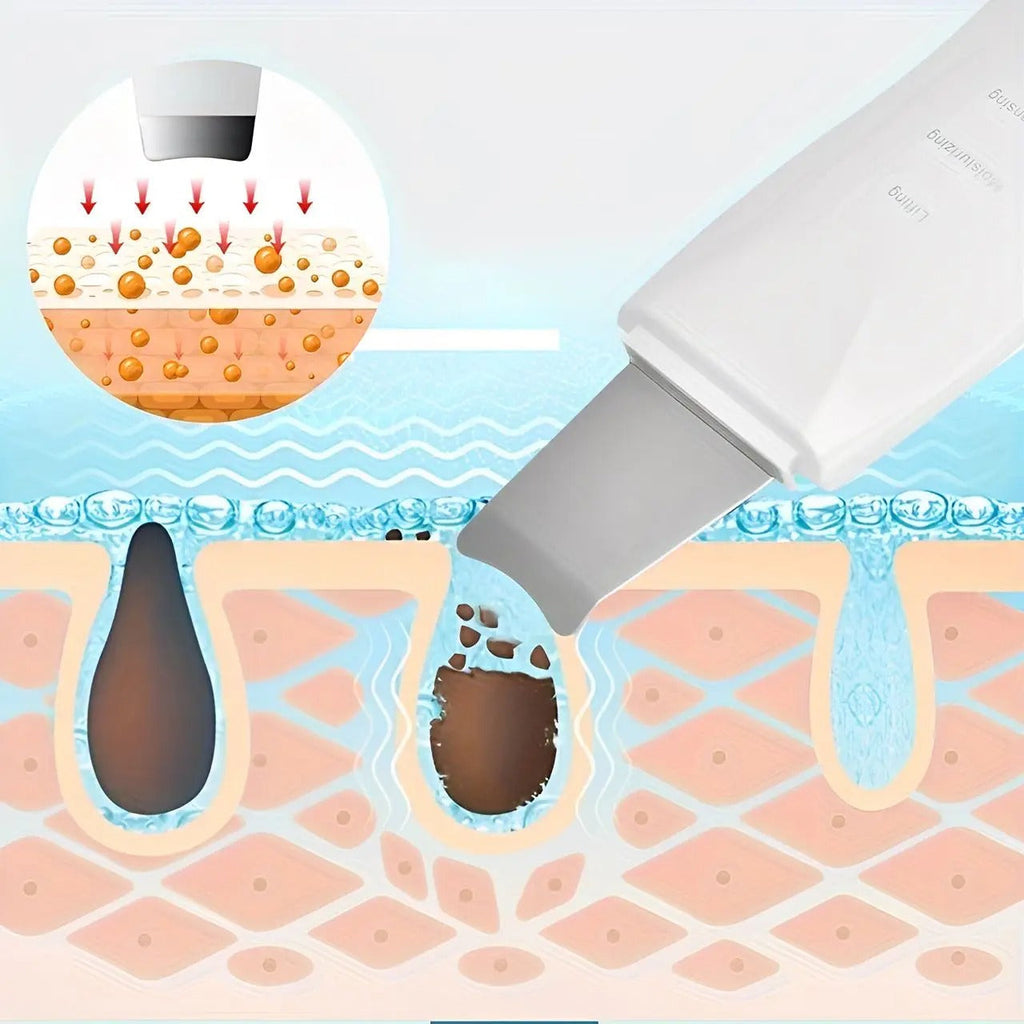 Peeling Ultrassônico Facial Portátil
