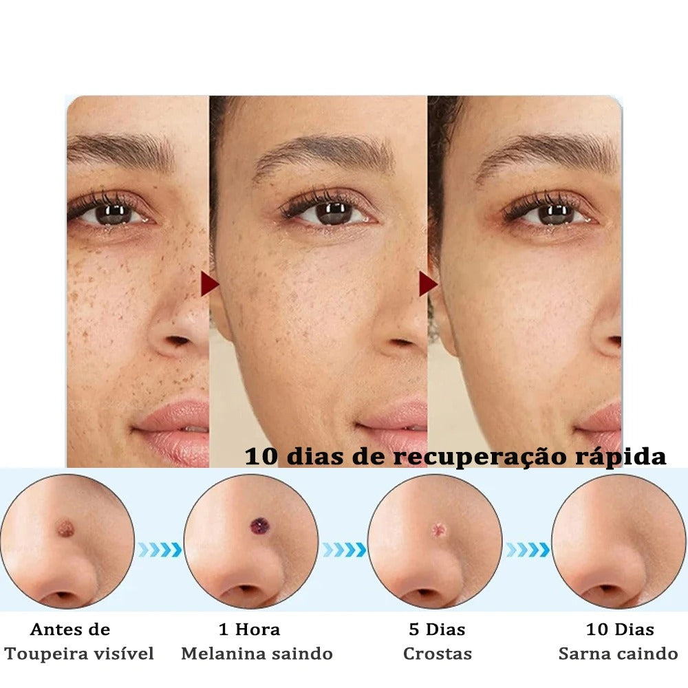 Caneta Plasma Elétrica 19 Níveis