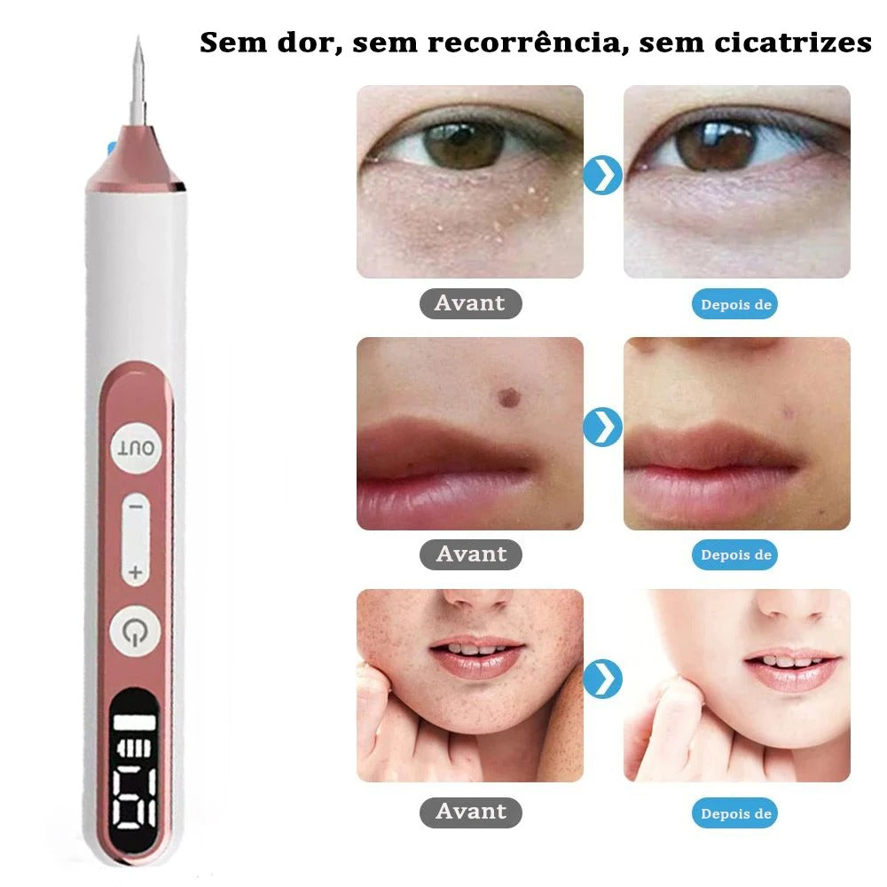 Caneta Plasma Elétrica 19 Níveis